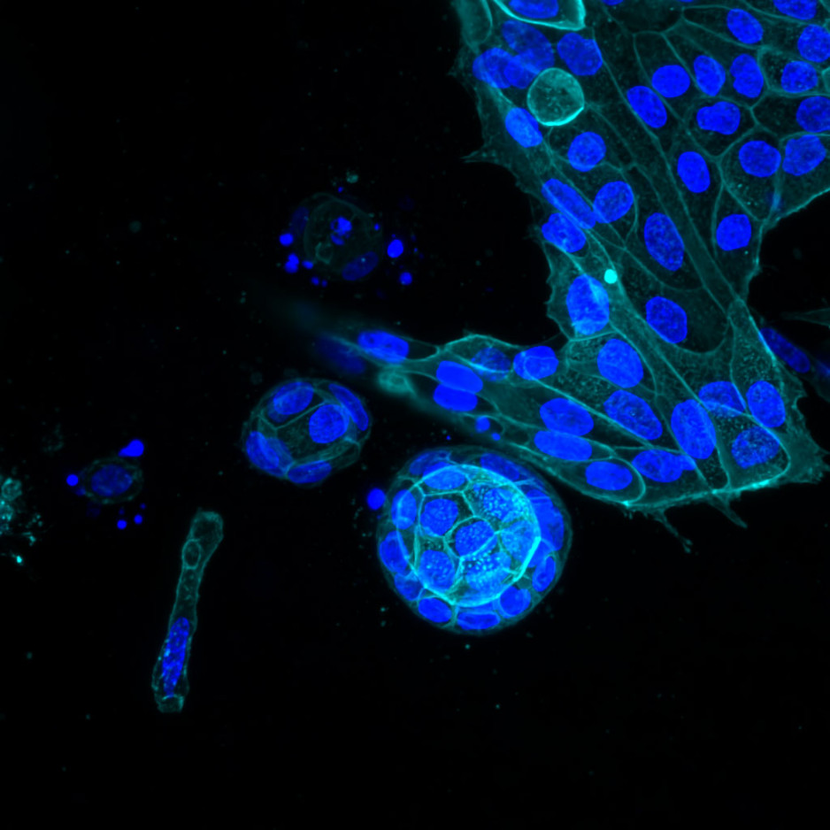 an image of live cells lit up through a confocal microscope