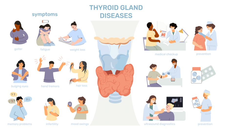 thyroid disease - stages