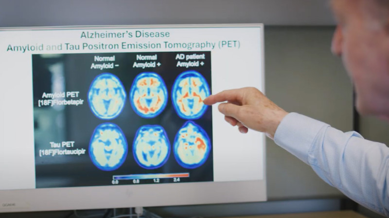 A Lawson researcher reviewing brain scan images looking for possible ways of preventing, detecting and treating brain damage and disease.