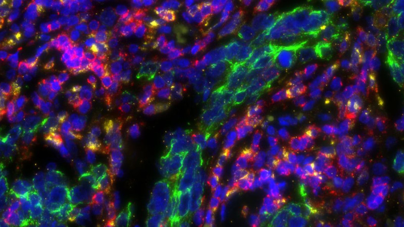 Molecular images of TNBC