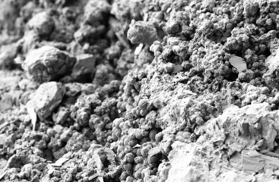 Scanning electron microscopy images showing organic material, crystals, and bacteria present on the surface of the ureteral stents