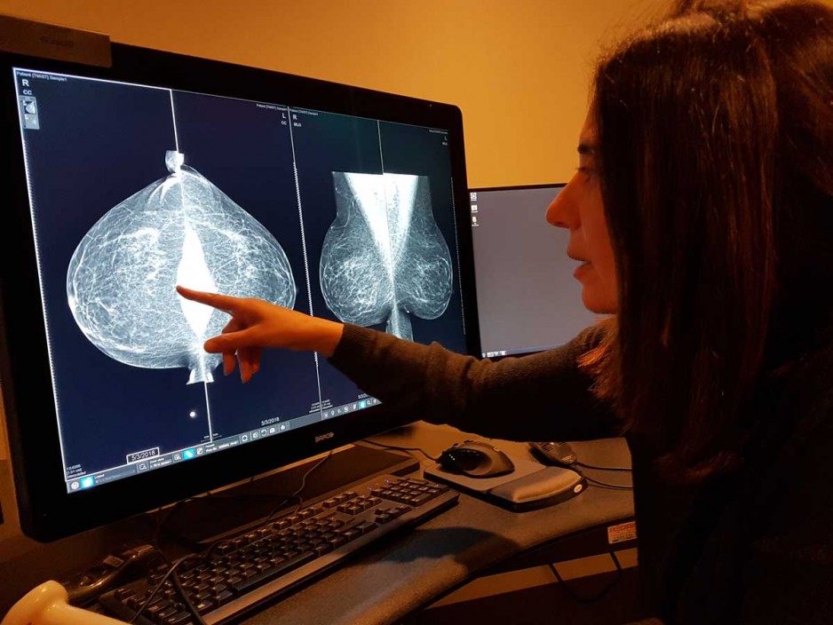  Dr. Anat Kornecki, Breast Radiology Lead with St. Joseph’s Breast Care Program calls contrast-enhanced mammography “a game changer” in breast imaging and the detection of breast cancer. 