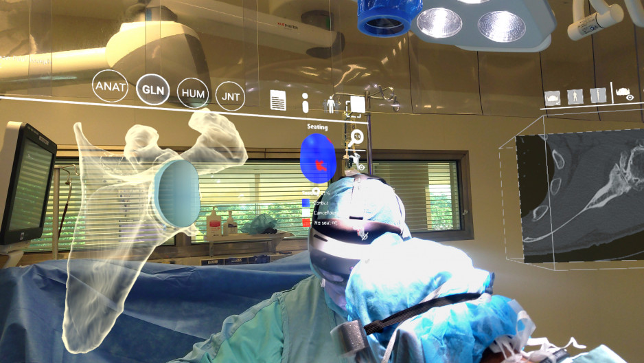 A view seen through the HoloLens2 of a shoulder joint, suspended overtop of the operating surgeons