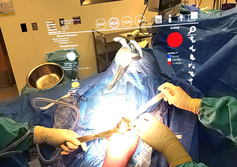 a view through the HoloLens showing shoulder replacement surgery with the surgeon's instruments in the incision