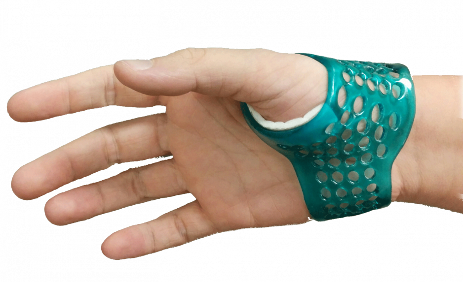 hand splint