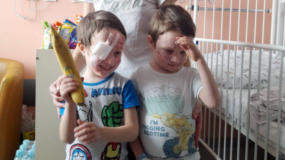 children in Ukraine with eye injuries