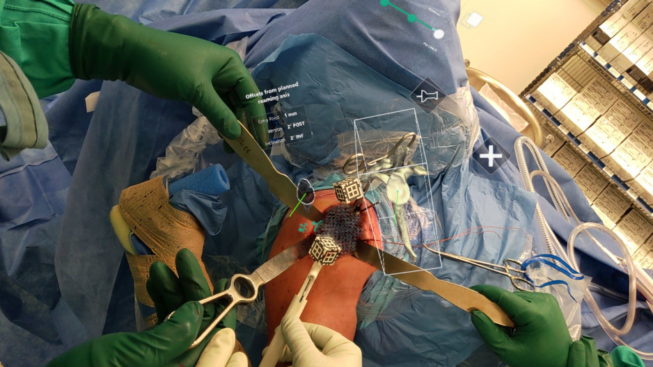 holo lens view during surgery