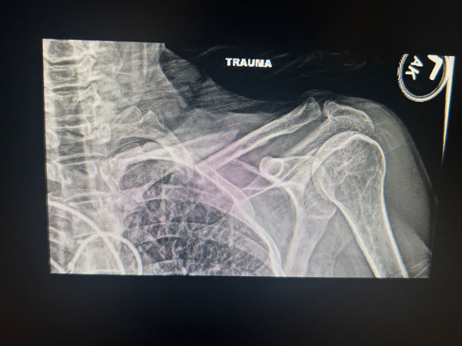 X-rays from Janet Tufts with a legend that says: "Trauma"
