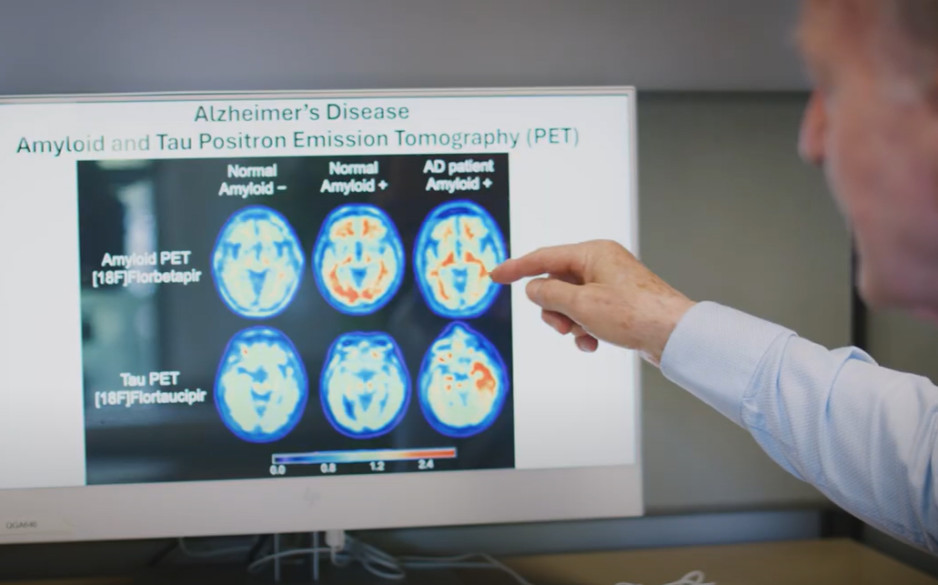 A Lawson researcher reviewing brain scan images looking for possible ways of preventing, detecting and treating brain damage and disease.