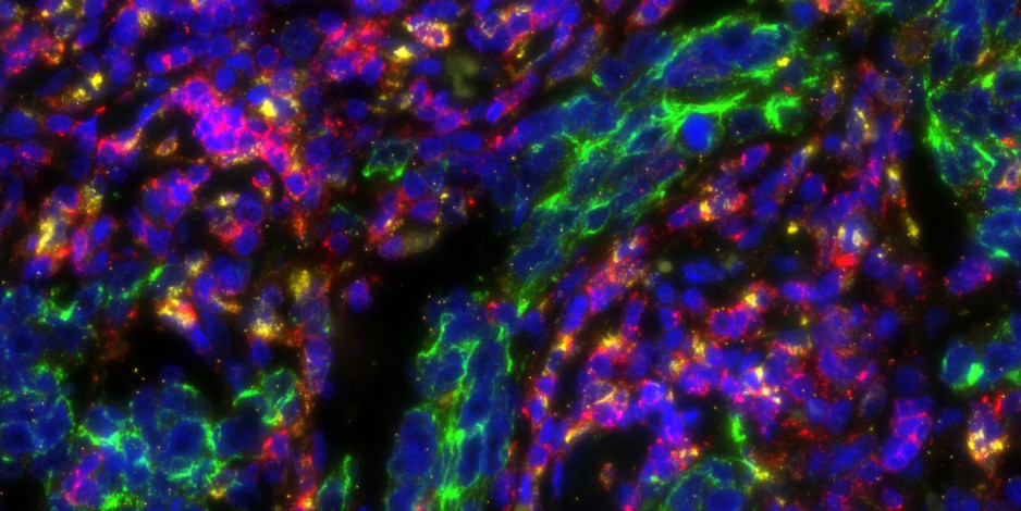 Molecular images of TNBC