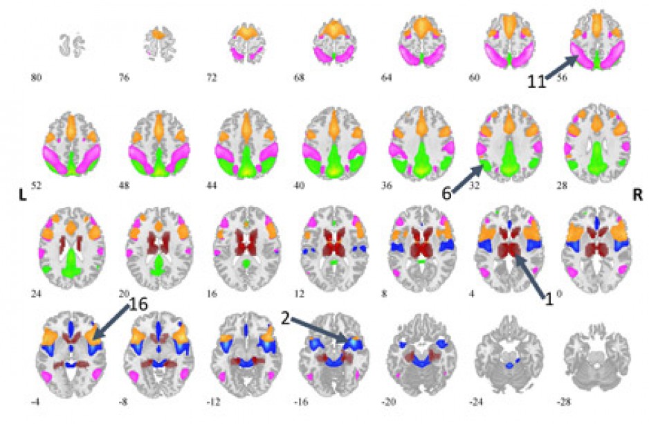 Research brain scan images