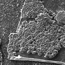 Microscopy image of stent