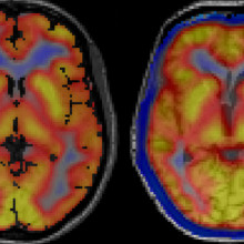 Brain images from imaging machine