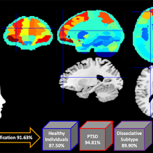 Brain scans from Lawson research study