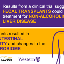 Fecal transplant graphic